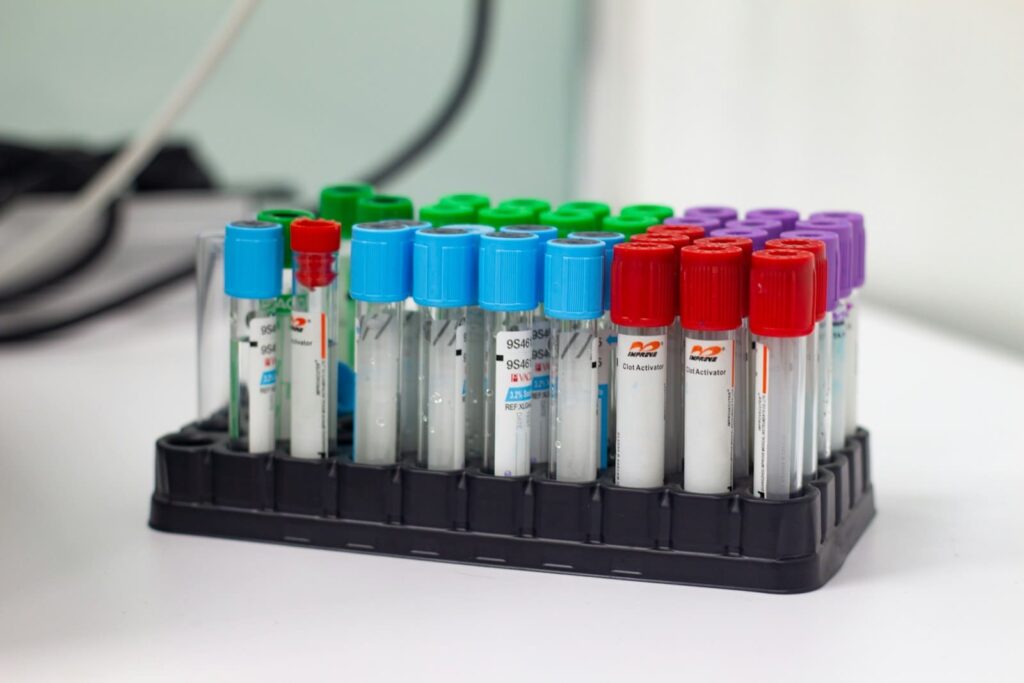 Rack of colour-capped specimen tubes, illustrating chlamydia and gonorrhoea PCR testing