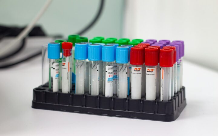 Rack of colour-capped specimen tubes, illustrating chlamydia and gonorrhoea PCR testing