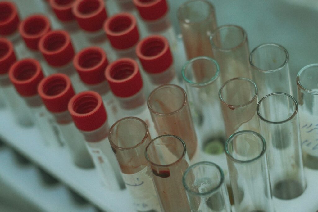 Blood sample tube in a laboratory rack ready for an HIV test after PEP