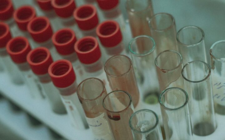 Blood sample tube in a laboratory rack ready for an HIV test after PEP