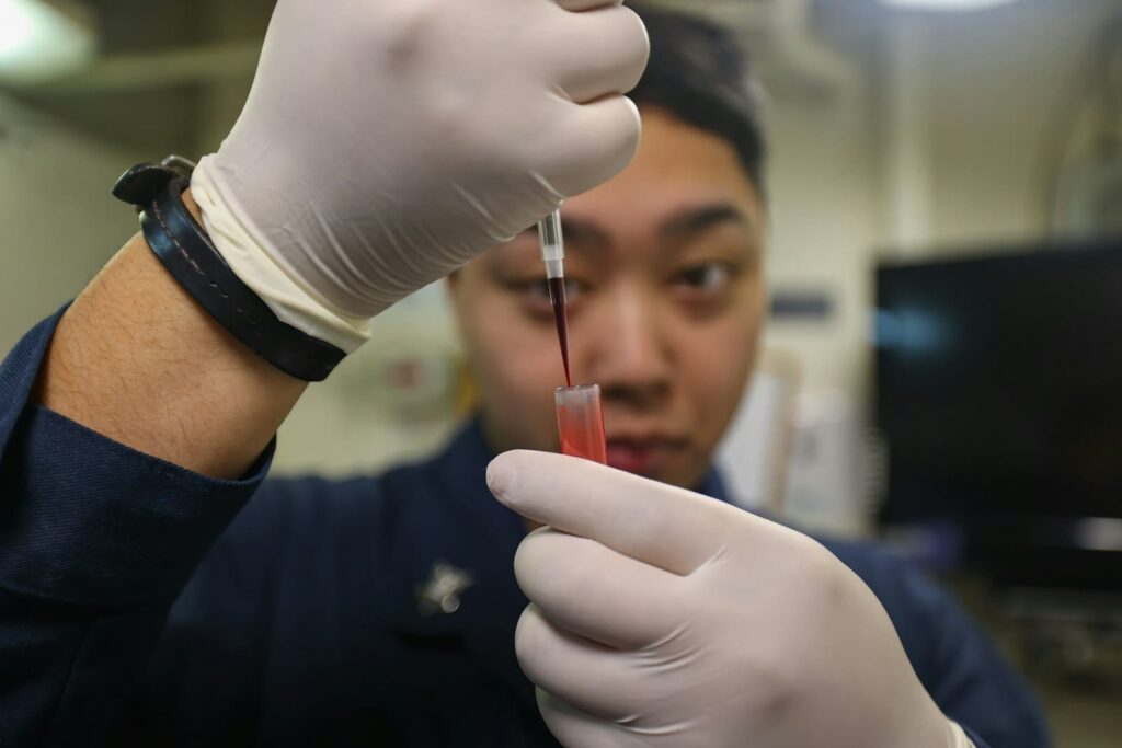 Blood sample tube in a laboratory rack, representing an HIV test on Koh Samui