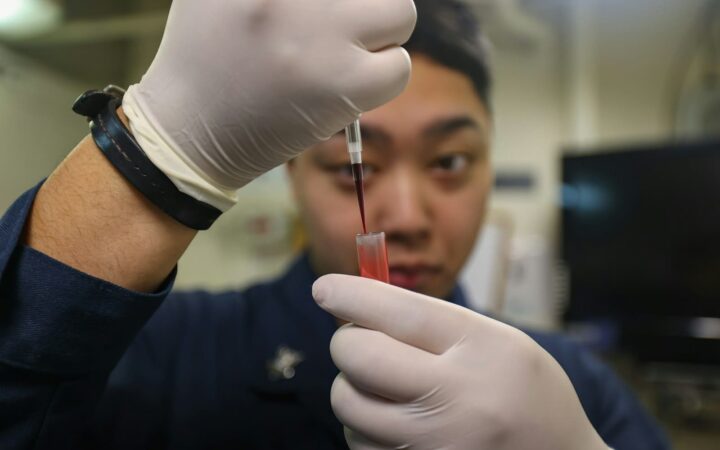 Blood sample tube in a laboratory rack, representing an HIV test on Koh Samui