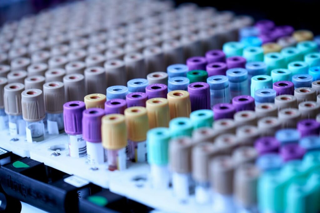 Rows of blood collection tubes in a laboratory, the kind of samples used to detect HIV after the window period
