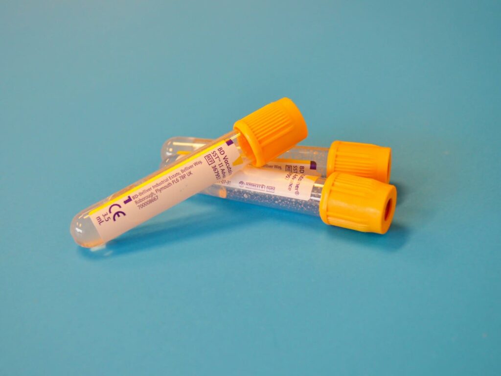 Sample cup and lab form on a counter, illustrating STD test prices on Koh Samui
