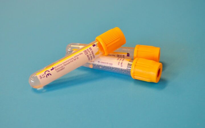 Sample cup and lab form on a counter, illustrating STD test prices on Koh Samui