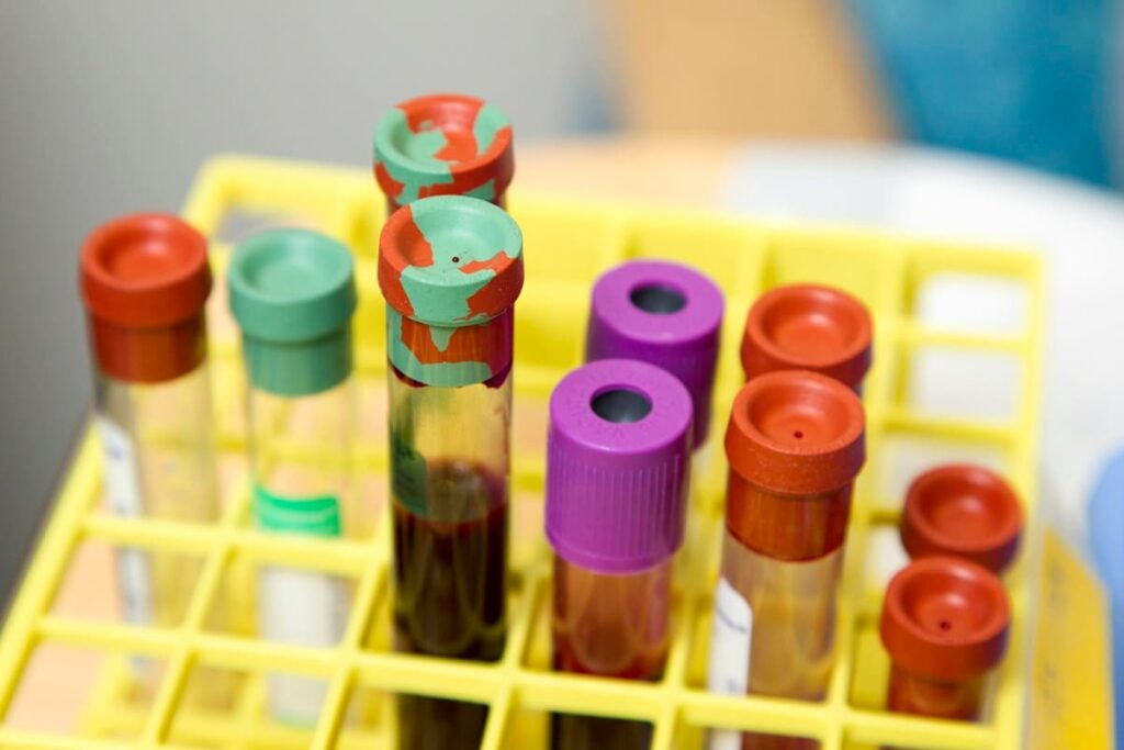 Blood sample vials in a rack at a laboratory, used for HIV and syphilis tests for travellers